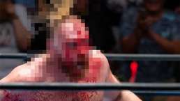Видео: Джону Моксли вонзили в голову связку палочек для еды на шоу NJPW