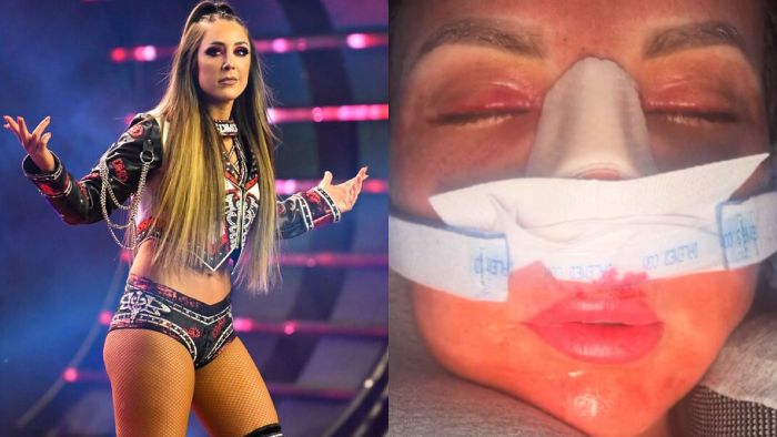 Возвращение произошло в AEW на Collision; Харли Кэмерон перенесла операцию и другое