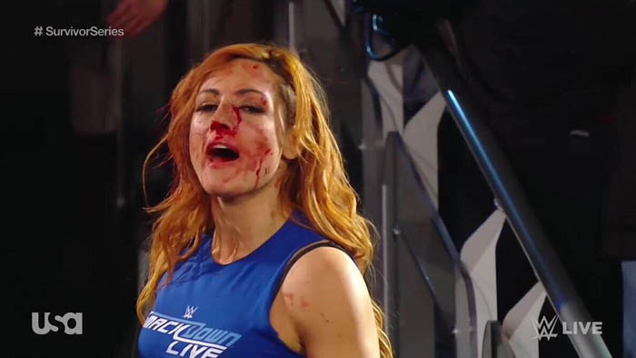 WWE отменили матч Линч против Раузи на Survivor Series из-за нескольких травм Бекки Линч